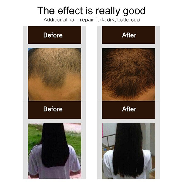 Purc 30ml Hair Growth Spray Natural Ginger Essence Spray Effective Extract Anti Hair Loss Nourish Root Hair Care Treatment