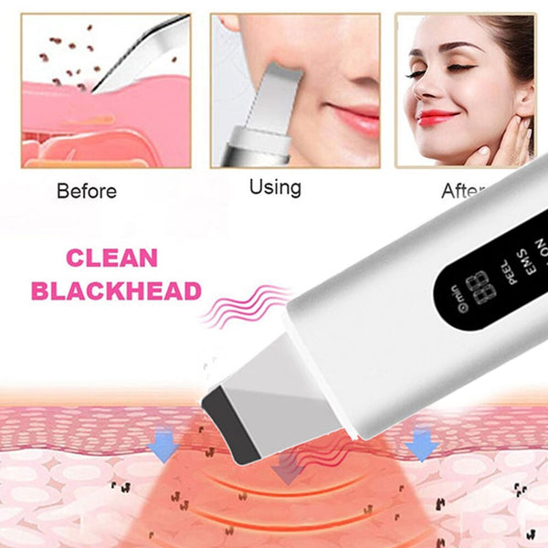 Ultrasonic Atomizing Skin Scrubber Blackhead Acne Remover Heating Deep Cleansing Facial Peeling Shovel Face Clean Skin Care（DYM-013）