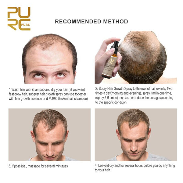 Purc 30ml Hair Growth Spray Natural Ginger Essence Spray Effective Extract Anti Hair Loss Nourish Root Hair Care Treatment